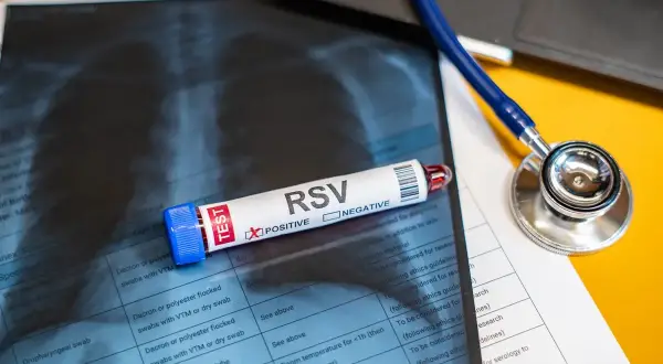Test RSV z zaznaczonym wynikiem "POSITIVE" leży na zdjęciu rentgenowskim klatki piersiowej. Obok stetoskop.