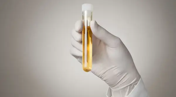 Jak skutecznie wykonać test na amfetaminę z moczu w domu?