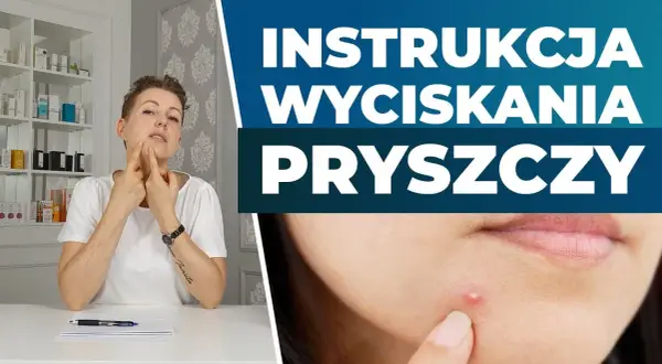 Wycisnęłaś pryszcza? Szybka pomoc, by uniknąć blizn i infekcji