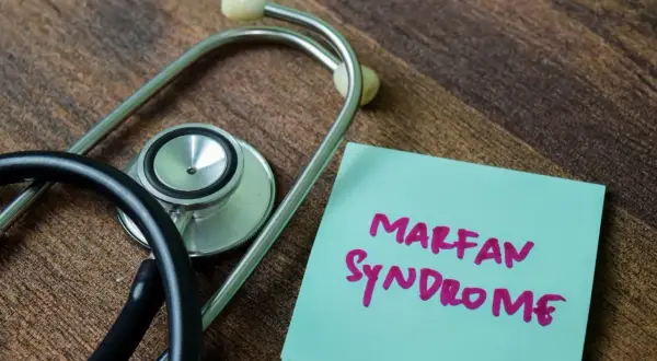 Stetoskop obok notatki z napisem "Marfan Syndrome". Informacja o chorobie, która może dotyczyć wielu układów.
