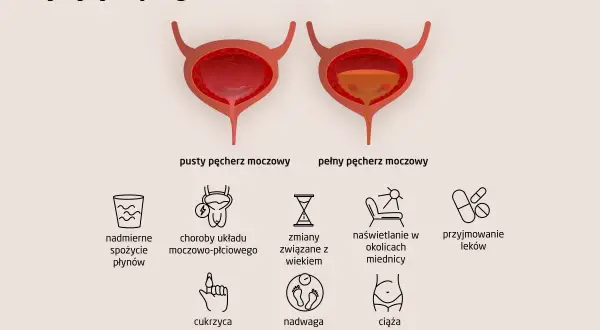 Ilustracja pokazuje przyczyny problemów z oddawaniem moczu u mężczyzn: nadmierne picie, choroby układu moczowo-płciowego, wiek, naświetlanie, leki, cukrzyca, nadwaga, ciąża.