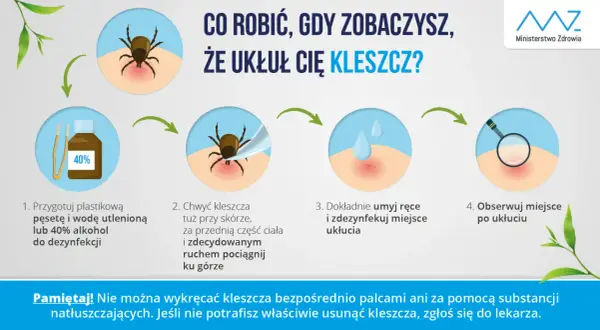 Instrukcja usuwania kleszcza. Pamiętaj, że kleszcz może wejść do ucha, ale ta metoda pomoże go usunąć.
