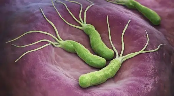 H. pylori w ustach: objawy, diagnoza i leczenie | Poznaj związek