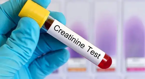 Kreatynina: przygotowanie do badania. Wyniki bez fałszu!