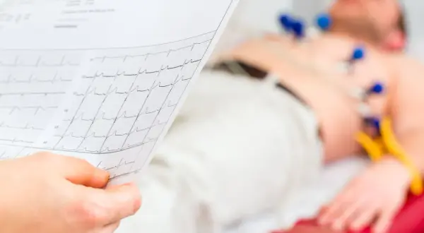EKG spoczynkowe: Co wykryje, a czego nie? Pełna prawda o sercu