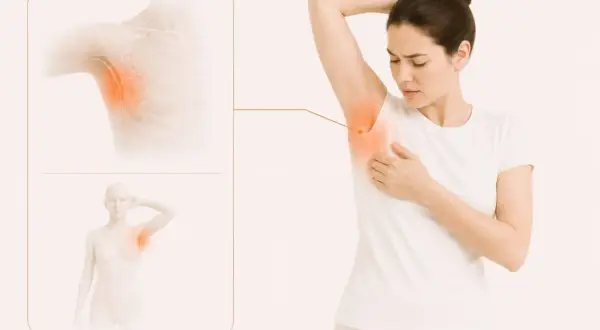 Kvinna känner smärta i armhålan, illustrerad med en röd glöd. Anatomiska bilder visar orsaken till ont i armhålan.
