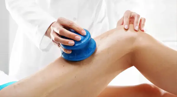 Masaż bańką chińską na udzie. Terapeuta wykonuje zabieg, przesuwając niebieską bańkę po skórze.