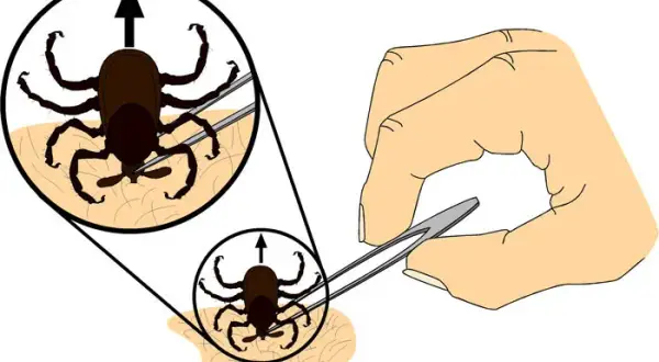 Cómo matar una garrapata de forma segura y evitar infecciones