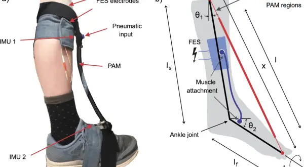 Sistema di elettrostimolazione per piede cadente con sensori IMU e attuatore PAM.