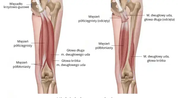 Anatomia mięśni uda: mięsień półścięgnisty i półbłoniasty, głowy mięśnia dwugłowego uda.