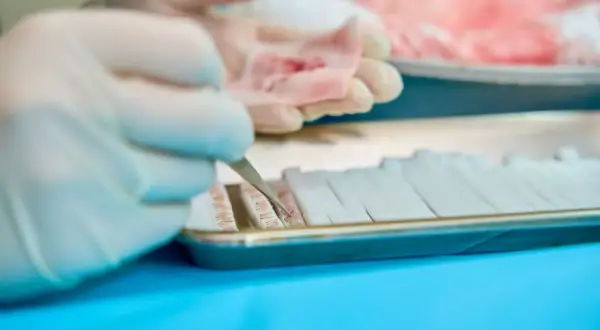 Ręce w rękawiczkach precyzyjnie układają próbki tkanki. Czy biopsja jest bezpieczna? To kluczowe pytanie w diagnostyce.