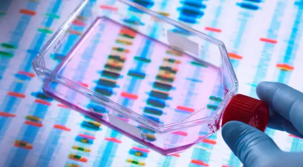 Badanie DNA w celu wykrycia mutacji genetycznych związanych z chorobą Pompego. Ręka w rękawiczce trzyma pojemnik z próbką na tle elektroforezy.