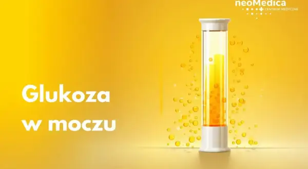 Badanie poziomu glukozy w moczu. Kolba z żółtym płynem i pęcherzykami, symbolizująca analizę.
