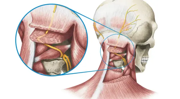 Anatomische Darstellung des Schädels und Nackens mit Fokus auf Nervenbahnen. Vergrößerter Bereich zeigt Nerven, die bei Occipitalis Neuralgie betroffen sein können.
