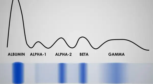 Wykres proteinogramu z frakcjami: albumina, alfa-1, alfa-2, beta, gamma. Widoczne pasma elektroforetyczne.