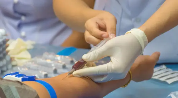 Zaburzenia hemostazy: objawy skaz krwotocznych i nadkrzepliwości