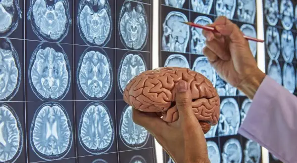 Chirurg neurolog analizuje przekroje mózgu na obrazach MRI, trzymając model ludzkiego mózgu.