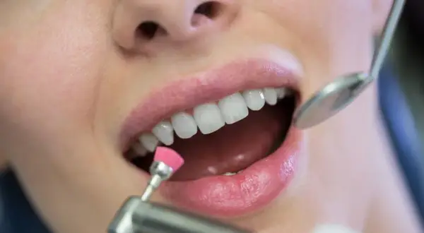 Zabieg fluoryzacji z użyciem szczoteczki i lusterka dentystycznego.