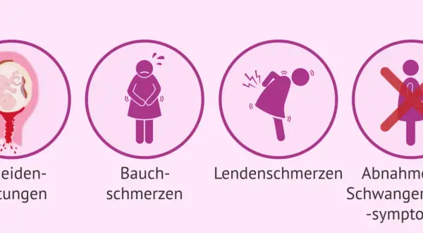 Anzeichen einer Fehlgeburt in der 17. SSW: Blutungen, Bauchschmerzen, Rückenschmerzen, Abnahme von Schwangerschaftssymptomen.