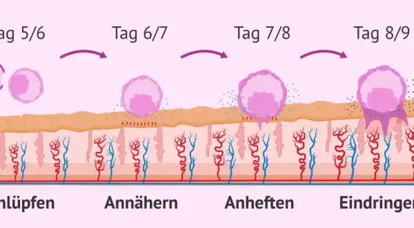 Was passiert nach dem Eisprung: Ein Embryo schlüpft, nähert sich, heftet sich an und dringt in die Gebärmutterschleimhaut ein.