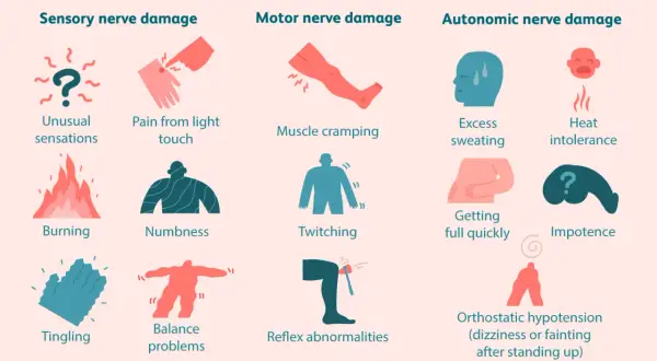 Danni ai nervi sensoriali, motori e autonomi, con sintomi come bruciore, intorpidimento, crampi, sudorazione eccessiva e problemi di equilibrio, possibili manifestazioni di neuropatia da stress.
