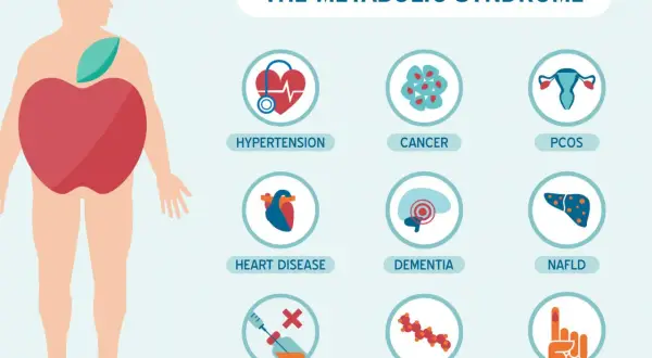 Ilustracja przedstawia zespół metaboliczny i jego powiązane schorzenia: nadciśnienie, choroby serca, insulinooporność, raka, demencję, problemy z lipidami, PCOS i cukrzycę typu 2.