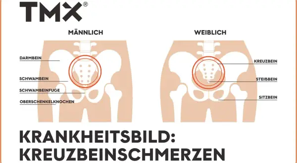 Vergleich männliches und weibliches Becken mit Hervorhebung des os sacrum. Illustration von Kreuzbeinschmerzen.