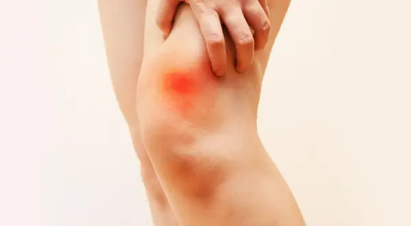 Mano che preme sul ginocchio con un'area rossa che indica dolore sopra al ginocchio.