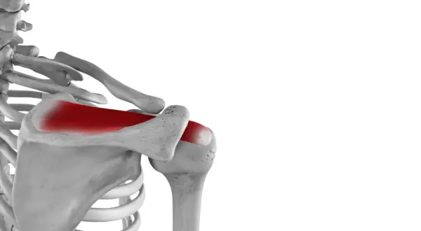Schulteranatomie: Rot hervorgehobene Supraspinatussehne. Bei einem Riss der Supraspinatussehne was tun?