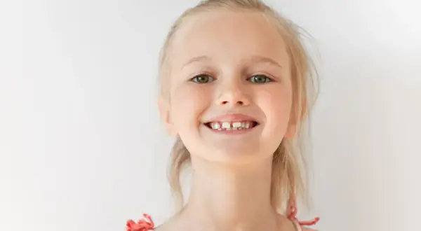 Uśmiechnięta dziewczynka z blond włosami, kiedy rosna 6 ząbków, pokazuje swoje nowe mleczaki.