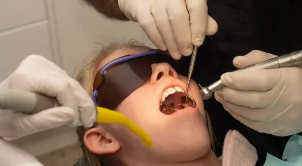 Usta pacjentki otwarte, w nich aparat ortodontyczny. Dentysta używa wiertła i lusterka. Wygląda jakby przygotowywał się do zabiegu, a nie jakby oglądał zwierzęta z rodziny **hyrax**.