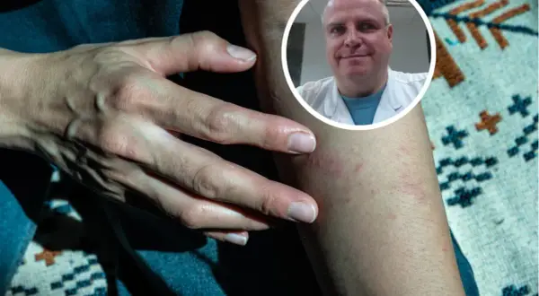 Dermatolog czy onkolog? Gdzie iść z niepokojącym znamieniem?