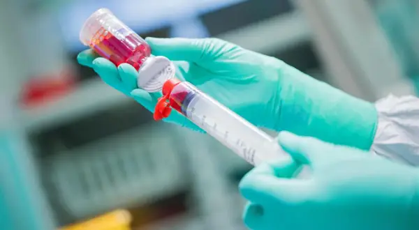 Hände in grünen Handschuhen ziehen rote Flüssigkeit aus einer Ampulle in eine große Spritze. Eine Chemotherapie-Spritze wird vorbereitet.