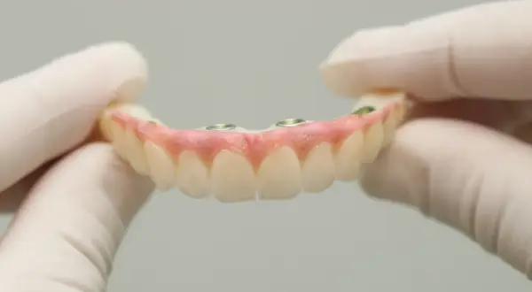 Górna proteza bez podniebienia, mocowana na implantach, prezentowana przez dłonie w rękawiczkach.