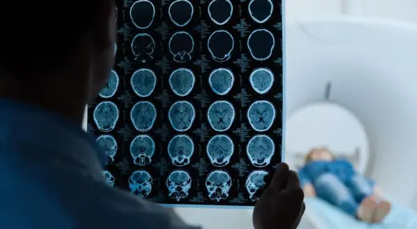 Lekarz analizuje wyniki rezonansu magnetycznego głowy, wykonanego w ramach testu na wstrząs mózgu. W tle pacjent leży w aparacie MRI.
