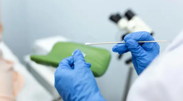 Ręce w niebieskich rękawiczkach przygotowują próbkę do badań cytologia wyniki. W tle mikroskop i fotel ginekologiczny.