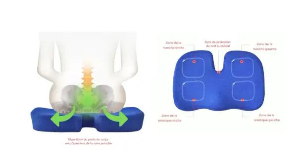 Coussin ergonomique pour soulager la névralgie pudendale. Répartit le poids pour protéger le nerf pudendal et les zones sensibles.