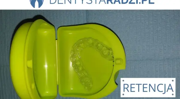 Przezroczysty retainer w zielonym etui, niezbędny do utrzymania efektów leczenia ortodontycznego. Retencja to klucz do pięknych zębów po aparacie.