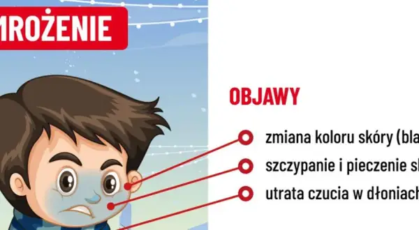 Chłopiec z bladą skórą i zmarzniętymi dłońmi, objawy odmrożenia: bladość, pieczenie, utrata czucia.