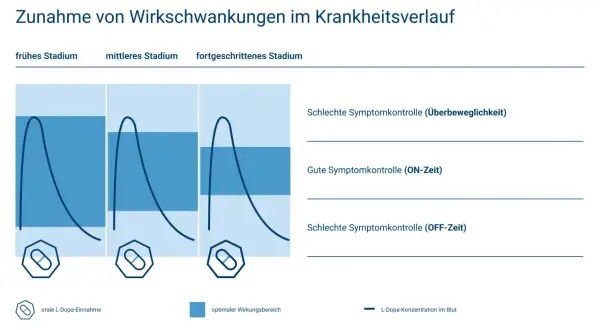 Grafik zeigt L-Dopa-Konzentration im Blut über die Zeit bei Parkinson. Mit zunehmendem Krankheitsverlauf (10 Jahre) werden die Schwankungen größer.
