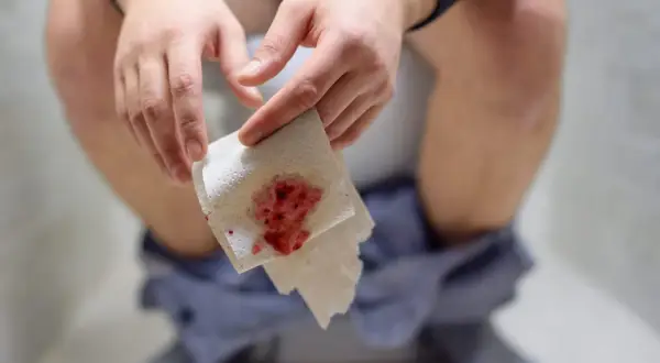 Dłoń trzymająca papier toaletowy z krwią, sugerujący problemy z hemoroidami, nawet u dzieci.