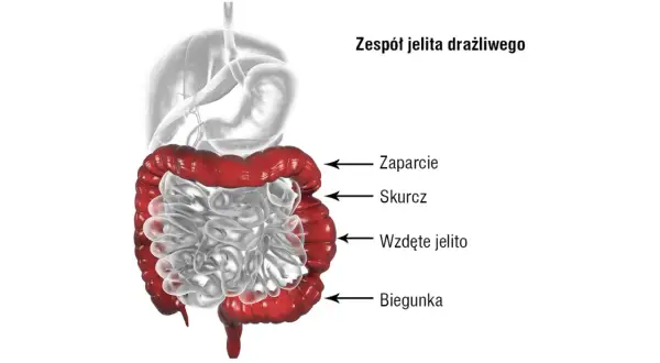 Zaburzenia motoryki jelit: objawy, przyczyny i kiedy szukać pomocy