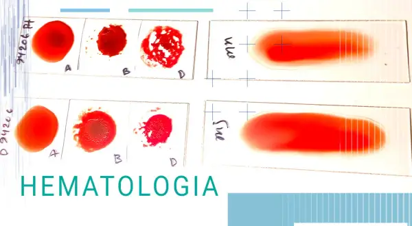 Zaburzenia hematologiczne co to - objawy, przyczyny i leczenie