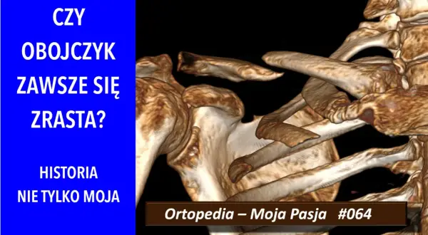 Trójwymiarowy obraz obojczyka i łopatki, z tekstem "CZY OBOJCZYK ZAWSZE SIĘ ZRASTA?".