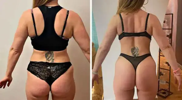 Prima e dopo: la trasformazione di una donna con glutei perfetti, più tonici e scolpiti.