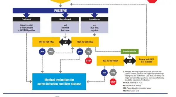 Schemat diagnostyki zakażenia HCV: badanie Anti-HCV, NAT, RIBA. Określa, hcv co to za badanie i dalsze kroki.