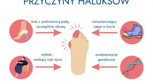 Czy haluksy są dziedziczne? Geny, buty i profilaktyka