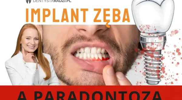 Implant zęba a paradontoza. Krwawiące dziąsła i implant zębowy z plamami krwi. Dentystka radzi.