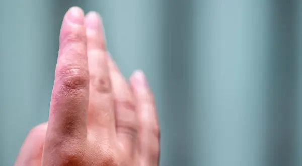 Skóra na opuszkach palców rąk jest zaczerwieniona i lekko łuszcząca się, co może wskazywać na swędzenie opuszków palców u rąk.