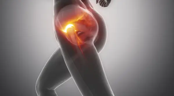 Ból w biodrze podczas biegu, widoczny jako czerwone, pulsujące światło. Przeskakujące biodro może być sygnałem problemów.